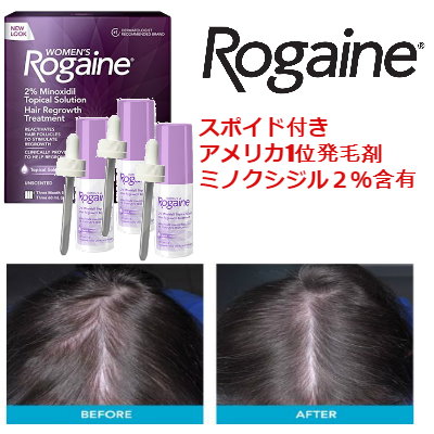 Qoo10 アメリカ一位発毛剤 ろゲイン ミノキシジ 健康食品 サプリ