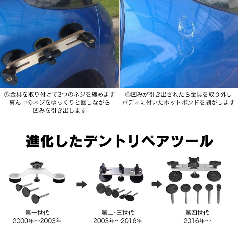 Qoo10 デントリペアツール 工具 車 へこみ 吸盤 かんたん修理 補修 凹み直し バキュームリフター ブリッジ 引っ張り 工具 板金屋不要 工具 修復 セット 商品 通販 自動車 ボディ フェンダー バイク