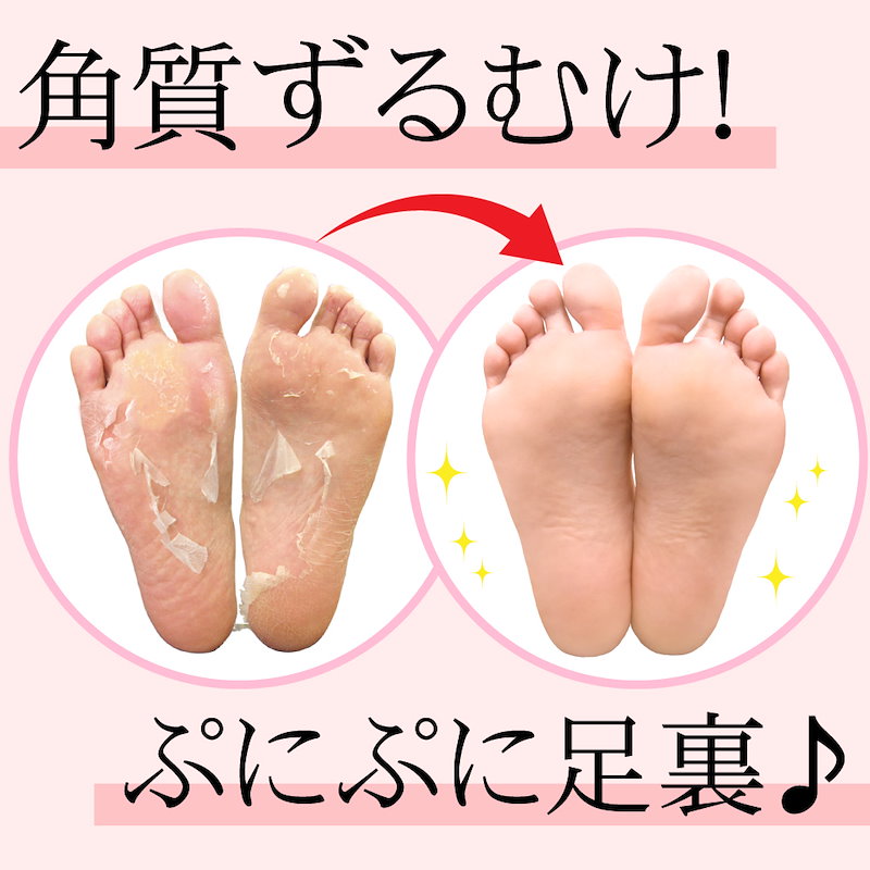 Qoo10 フットピーリングパックペロリン