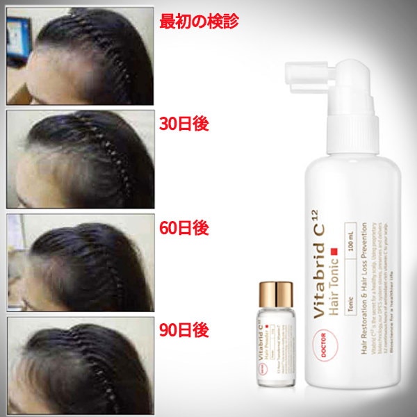 Qoo10 Newドクタービタハイブリッド C ヘアーパウダー1 5g ヘアートニック100ml 薬用 発毛 育毛 促進剤 韓国コスメ 頭皮 ヘア 毛髪 含光極損傷ケア 毛根栄養