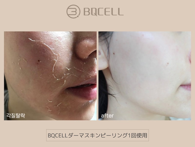 ホワイト系人気 ハーブピーリングキット パック フェイスマスク スキンケア 基礎化粧品ホワイト系 13 500 Eur Artec Fr