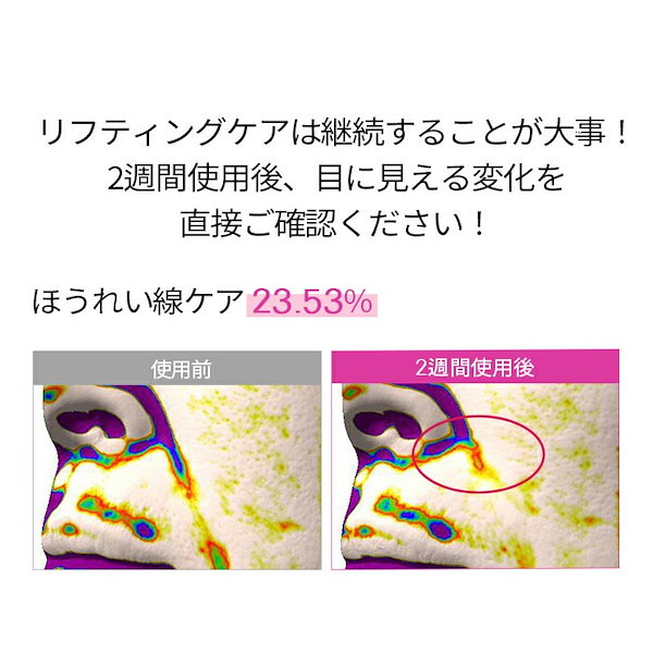 Qoo10] CKD_GUARANTEED レチノコラーゲン低分子 300 カッサ