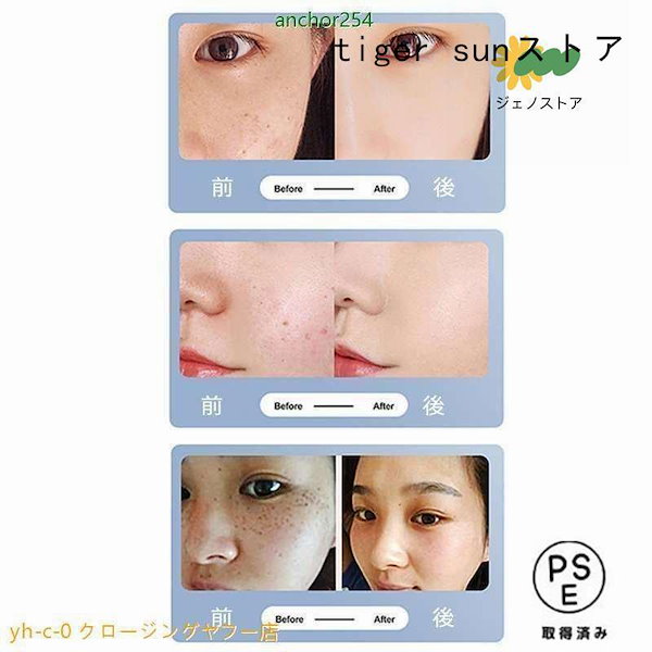 ピコ美顔器　青レーザー ピコ美顔器 青レーザー