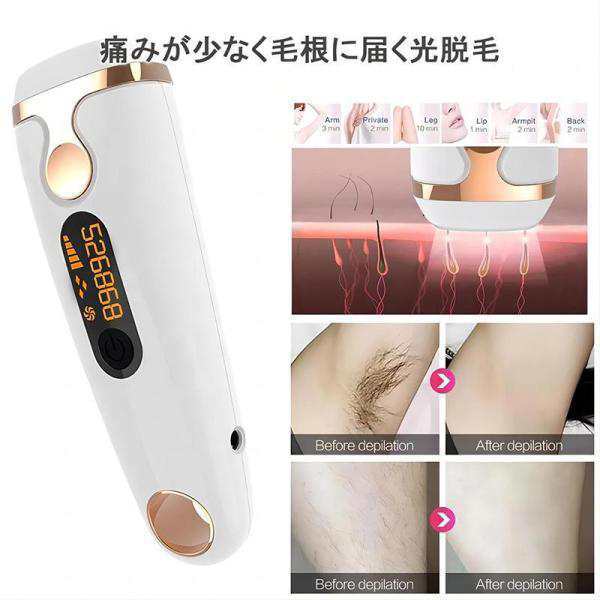脱毛器 女性 メンズ 髭 vio対応 脱毛機 脱毛 光 家庭 痛くない ムダ毛 除毛 美肌 美白 腕 脚 脇毛 ヒゲ 全身脱毛 プレゼント 脱毛器 女性 メンズ 髭 vio対応 脱毛機 脱毛 光 家庭 痛くない ムダ毛 除毛 美肌 美白 腕 脚 脇毛 ヒゲ 全身脱毛 プレゼント