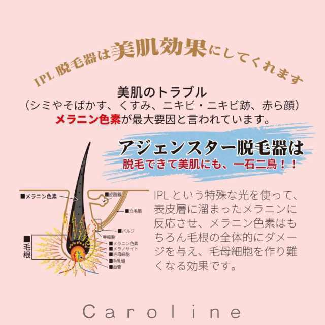 脱毛器 IPL光脱器 永久脱毛 家庭用脱毛器 自動照射 レーザー vio対応 メンズ レディース 脇 腕 足 背中 全身用 LED液晶 全身適用42 脱毛器 IPL光脱器 永久脱毛 家庭用脱毛器 自動照射 レーザー vio対応 メンズ レディース 脇 腕 足 背中 全身用 LED液晶 全身適用42