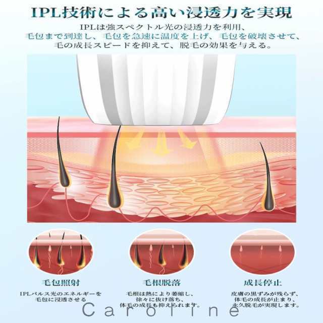 脱毛器 IPL光脱器 永久脱毛 家庭用脱毛器 自動照射 レーザー vio対応 メンズ レディース 脇 腕 足 背中 全身用 LED液晶 全身適用42 脱毛器 IPL光脱器 永久脱毛 家庭用脱毛器 自動照射 レーザー vio対応 メンズ レディース 脇 腕 足 背中 全身用 LED液晶 全身適用42
