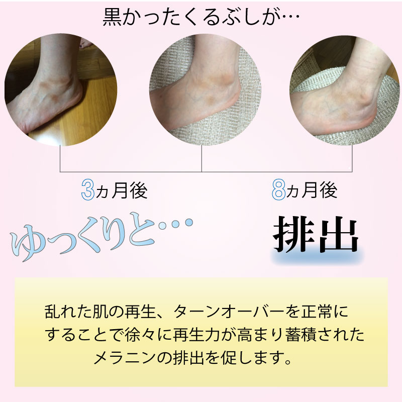 膝の黒ずみに着目した美白クリームLusTer ラスタークリーム（60ｇ）薬用美白濃密クリーム
