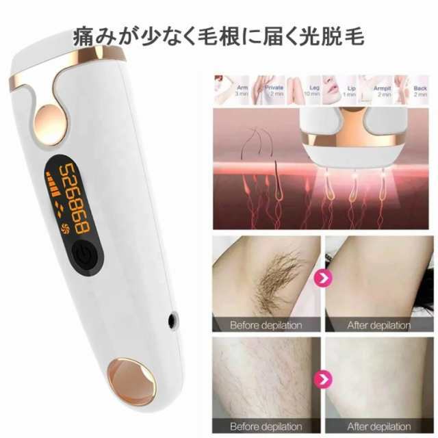 99万回以上 IPL 脱毛器 フラッシュ 男性 女性 ノンレーザー VIO 光 家庭用 脱毛 メンズ レディース 脱毛エステ ムダ毛 除毛 腕 脚 脇毛 髭 ヒゲ 全身脱毛 介護脱毛 ギフト 誕生日 99万回以上 IPL 脱毛器 フラッシュ 男性 女性 ノンレーザー VIO 光 家庭用 脱毛 メンズ レディース 脱毛エステ ムダ毛 除毛 腕 脚 脇毛 髭 ヒゲ 全身脱毛 介護脱毛 ギフト 誕生日