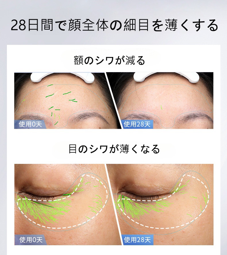 美顔器 美容器 自宅用美顔器 RF美顔器 EMS 微電流 温感機能 LED 1台多役 レベル イオン導出 イオン導入 光エステ 目元ケア 肌ケア 口元ケア 多機能 美容器男女兼用 ギフト