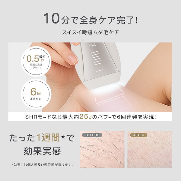 Qoo10] yete 【SNSで人気推奨の脱毛器！全新升级モデ