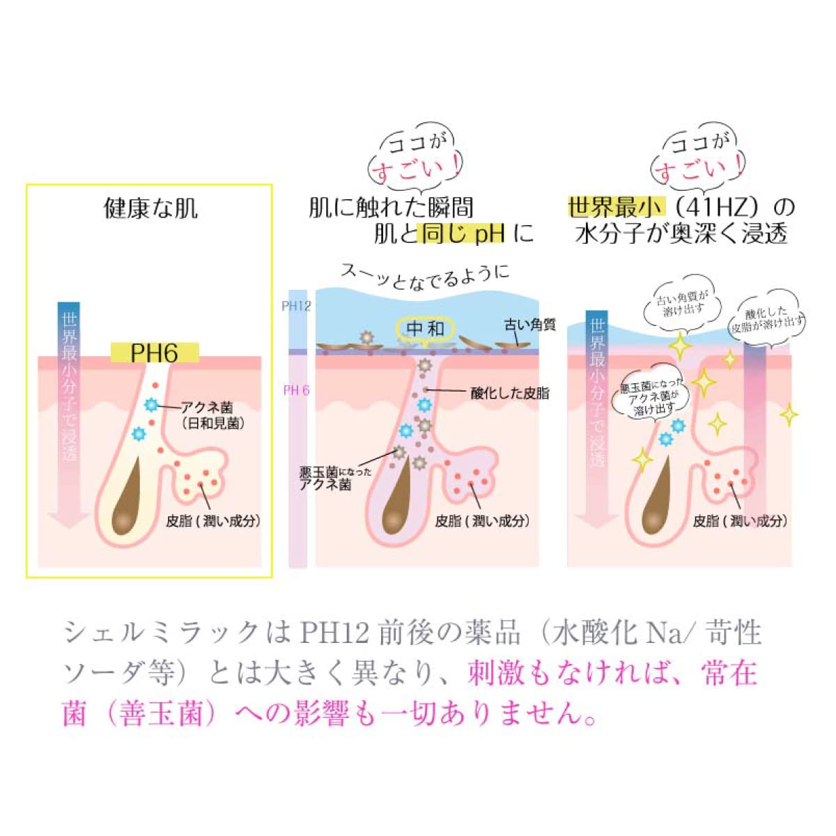 シェルミラック スキンコンディショナー (スキンコンディショナー200ml＆エッセンスローション150ｍl)