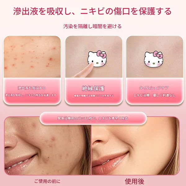 ハローキティ ニキビパッチ　HELLO KITTY ニキビパッチ　ケース付き ハローキティ ニキビパッチ HELLO KITTY ニキビパッチ ケース