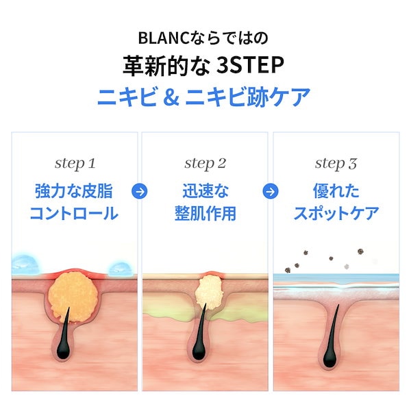 【3本】Blanc ブラン マジックシカクリーム 60ml　カタツムリクリーム 楽天市場】【☆07.25限定、エントリーで1/2確率ポイント100