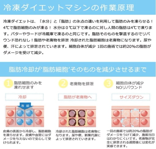家庭キャビテーション 冷凍ダイエットマシン 脂肪冷却 セルライト痩身マシン 腹部 太もも お腹 お尻 背中 ヒップ キャビテーション 自宅 簡単本格エス 家庭キャビテーション 冷凍ダイエットマシン 脂肪冷却 セルライト痩身マシン 腹部 太もも お腹 お尻 背中 ヒップ キャビテーション 自宅 簡単本格エス