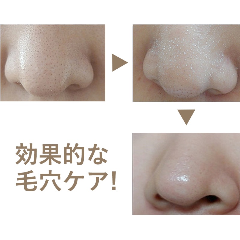 [Super Extractor] 350ml 黒ずみローション ブラックヘッドホワイトヘッ