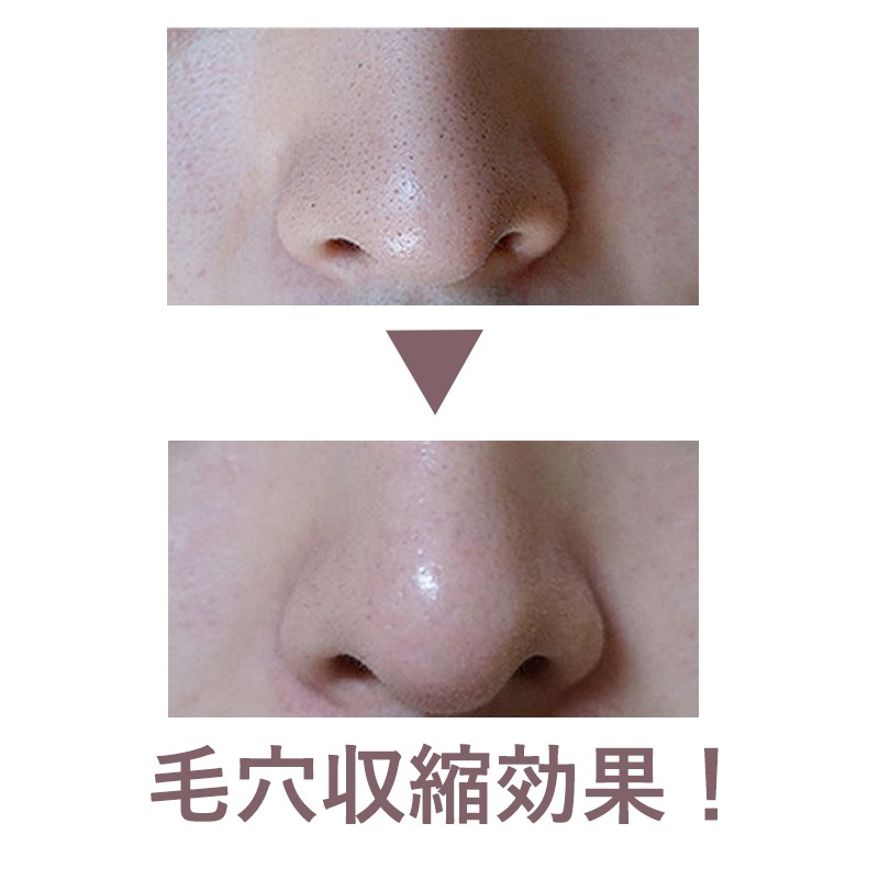 [Super Extractor] 350ml 黒ずみローション ブラックヘッドホワイトヘッ