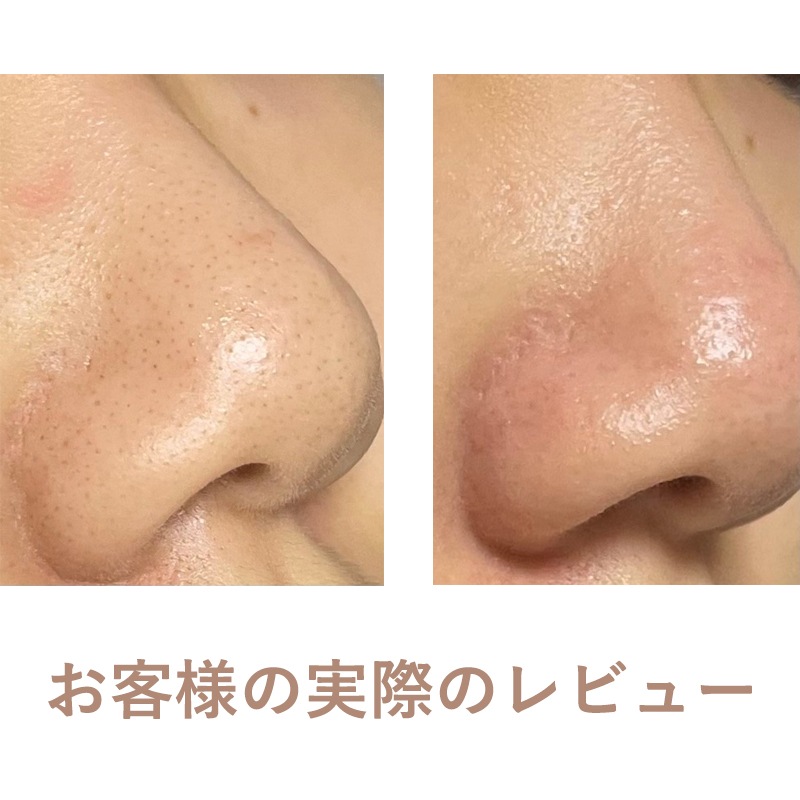 [Super Extractor] 350ml 黒ずみローション ブラックヘッドホワイトヘッ