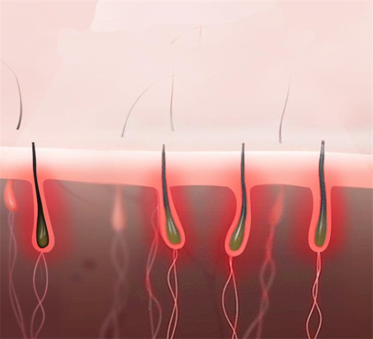 クオリティ保障大ヒット韓国ファッション レーザー 大人気 凝固点 脱毛器具 新品 永久 唇の脱毛 口ひげ 女性のみ 全身 シンプル ファッション 専用パーツ おしゃれな クオリティ保障大ヒット韓国ファッション レーザー 大人気 凝固点 脱毛器具 新品 永久 唇の脱毛 口ひげ 女性のみ 全身 シンプル ファッション 専用パーツ おしゃれな