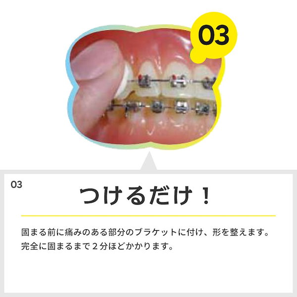 Gishy Goo™-Silicone Bracket Relief Aid