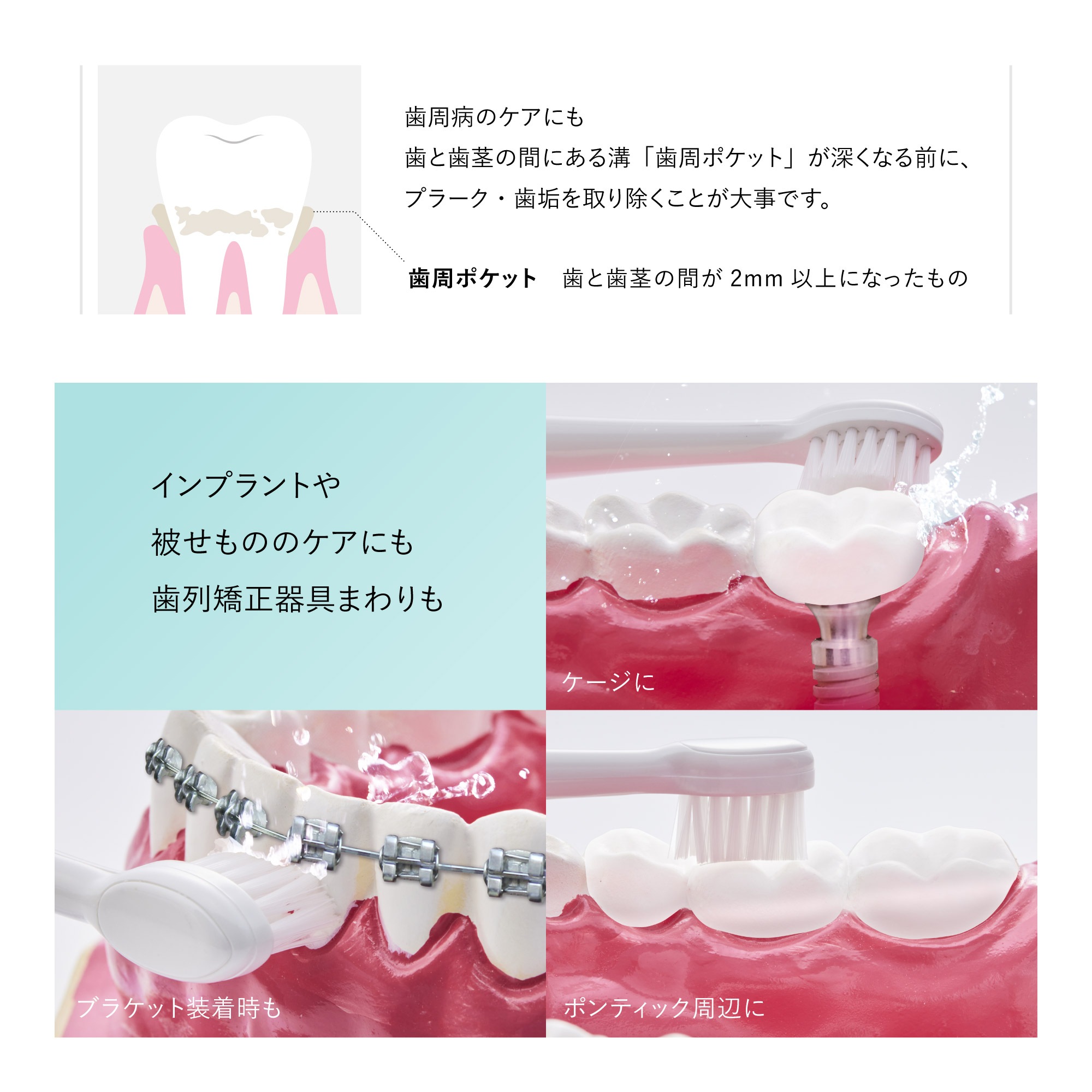 ジェットウォッシャー 初回版特典タンク付き ブラッシング ＆ フロス W効果 口腔洗浄器 ウォーターフロス 口腔洗浄機 電動歯ブラシ タフトブラシ