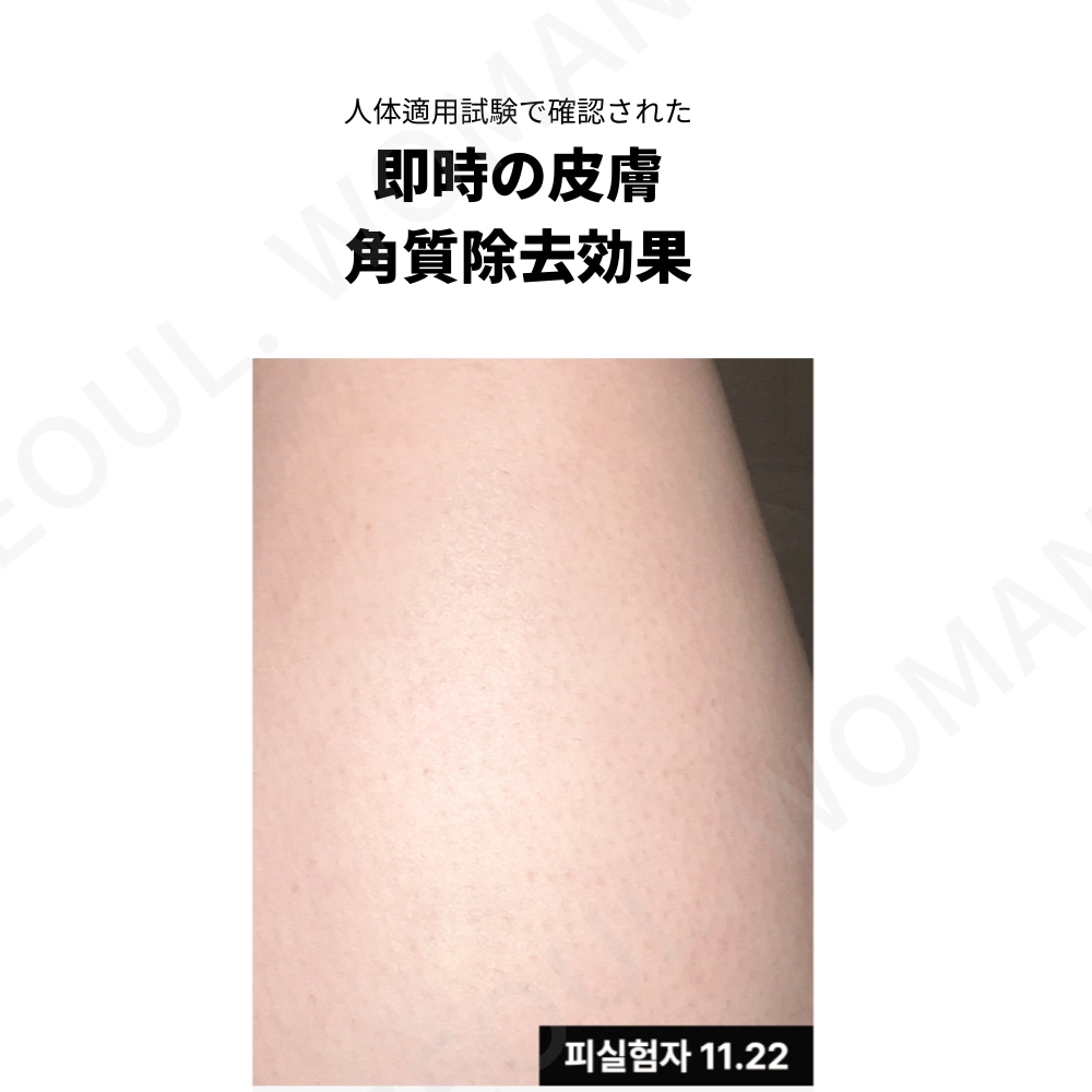 リメイン49 サルファー ボディローション 300ml [SNS人気] 毛穴角化症緩和し, なめらかな肌, 硫黄50,000ppm 配合 Sulfur Body Lotion