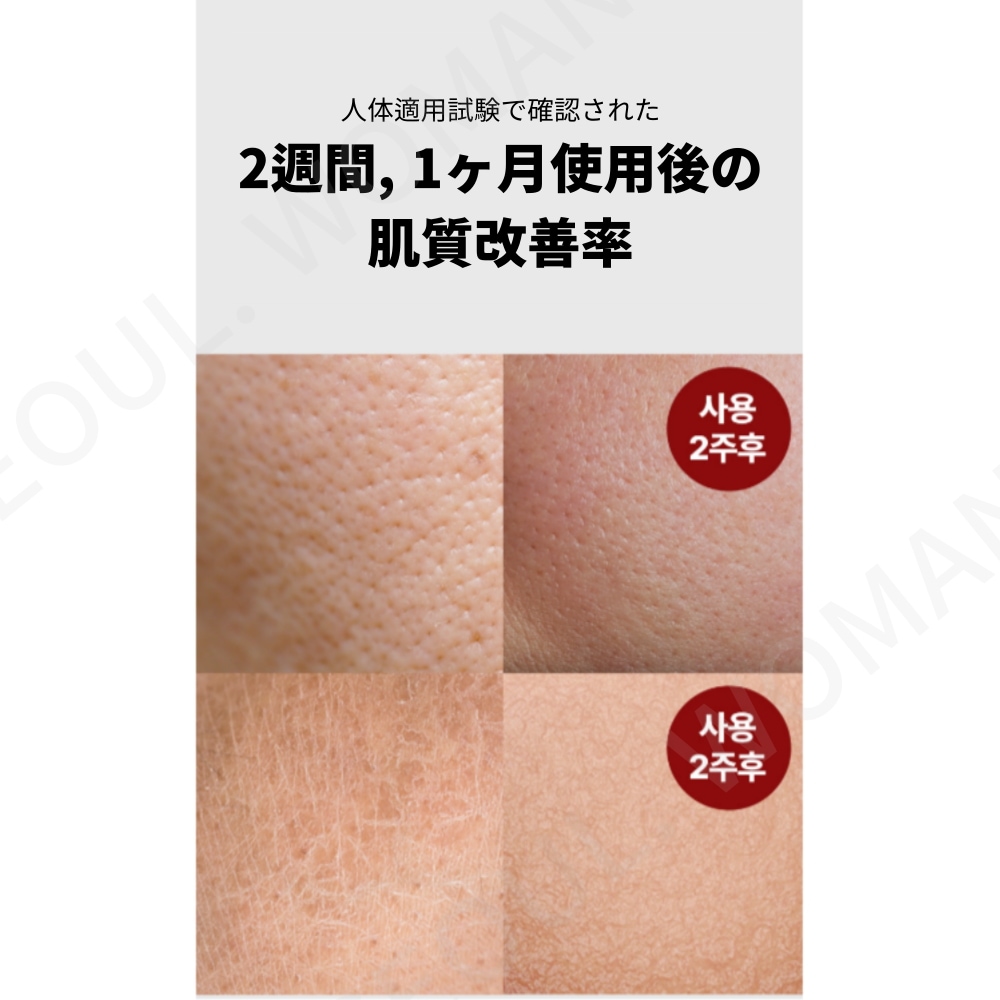 リメイン49 サルファー ボディローション 300ml [SNS人気] 毛穴角化症緩和し, なめらかな肌, 硫黄50,000ppm 配合 Sulfur Body Lotion