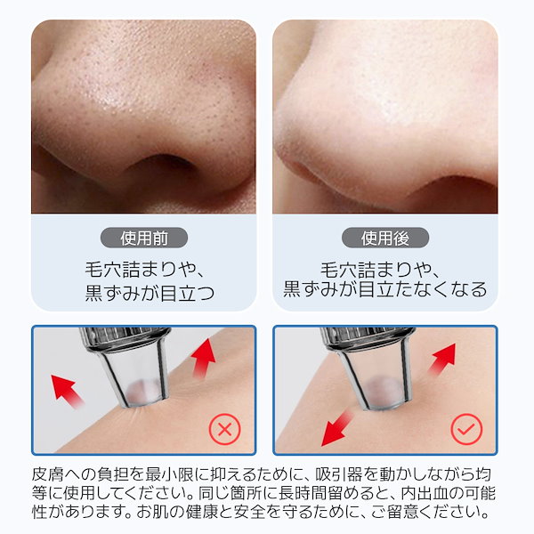 Qoo10] SARLISI サー リシ毛穴吸引器 美顔器 毛穴クリー