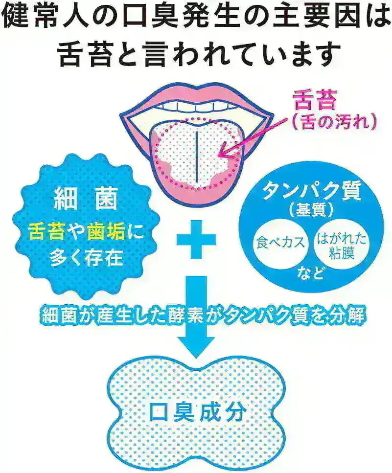 NONIO ノニオ 舌クリーナー 青 30本セット 口臭 舌 汚れ 舌みがき ブルー