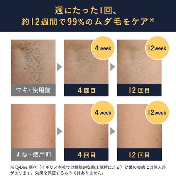 Qoo10] SMOOTHSKIN Pure Unplugged コードレス