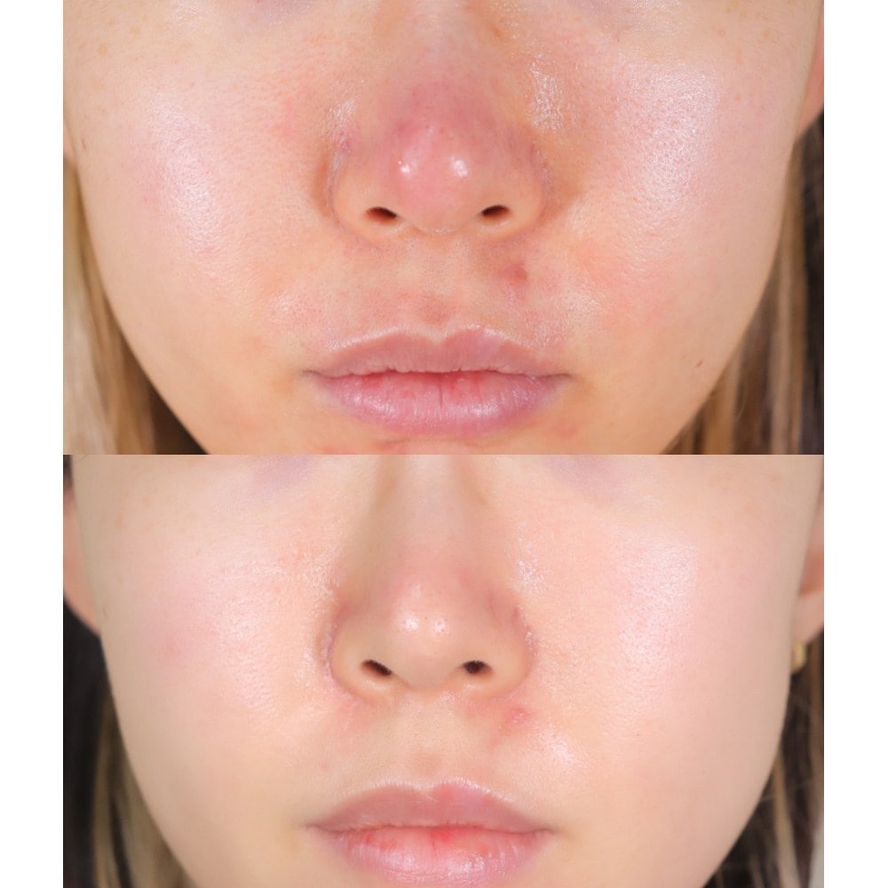 ルイビエル インテンシブ ホワイトニング ビタ モイスチャー クリーム 化粧品50ml5個 ルイビエル インテンシブ ホワイトニング ビタ モイスチャー クリーム 化粧品50ml5個