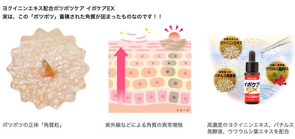 イポケアEX 18ml × 10本セット イポケアEX 18ml x2個セット 首 イボ 美容液 ブレーン