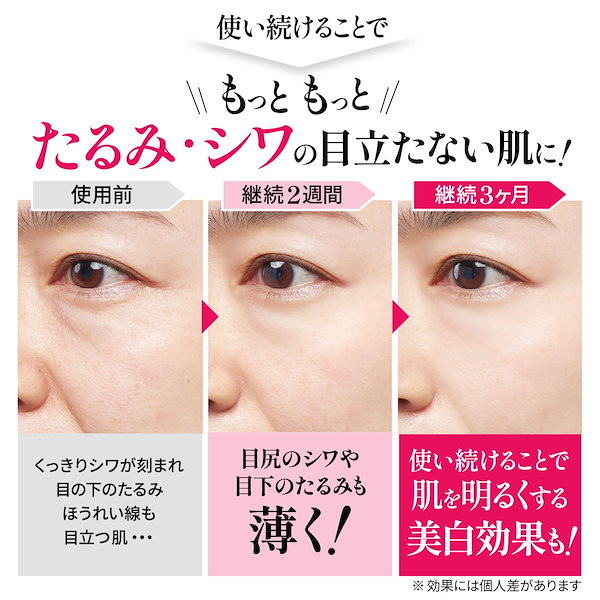 Qoo10] cosmejitan 薬用 シワ 改善パック ほうれい線 たる