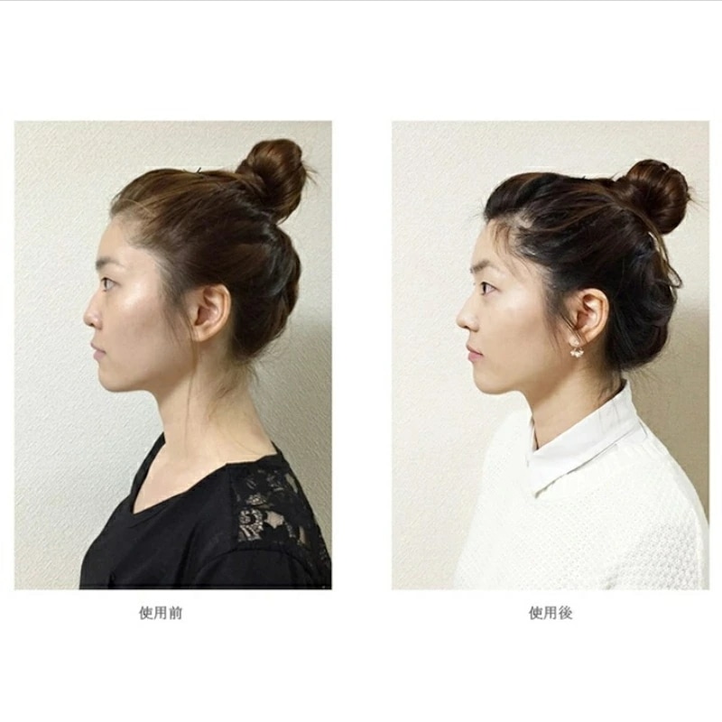 Qoo10] 鼻 高く ノーズクリップ 美鼻 補整器具