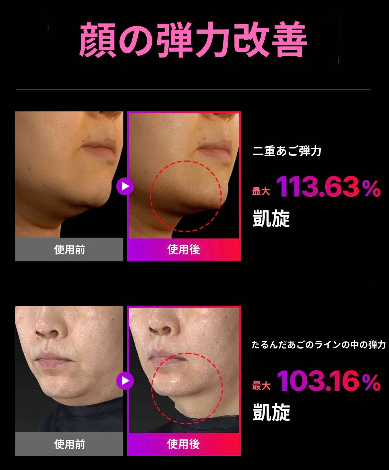 [ユ·シウンpick/1等ホーム経絡マッサジアイテム] マミケア EMSブイセラ(専用ブースティッグゼル贈呈）