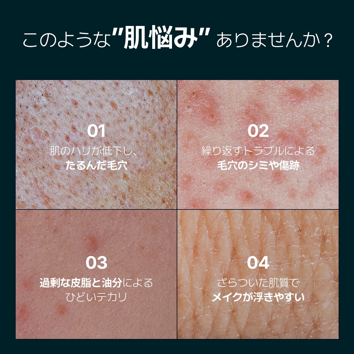 Qoo10] セロラバイ 毛穴タイトニングセラム 30ml / 満