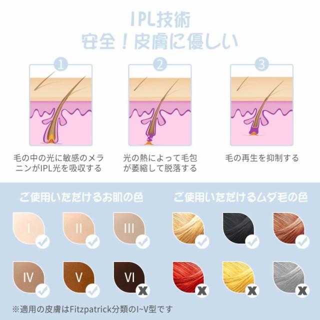 IPL光脱毛器 35万ショット 家庭用 自宅で簡単に脱毛 男女兼用 5段階調整 シルクエキスパート IPL光脱毛器 35万ショット 家庭用 自宅で簡単に脱毛 男女兼用 5段階調整 シルクエキスパート