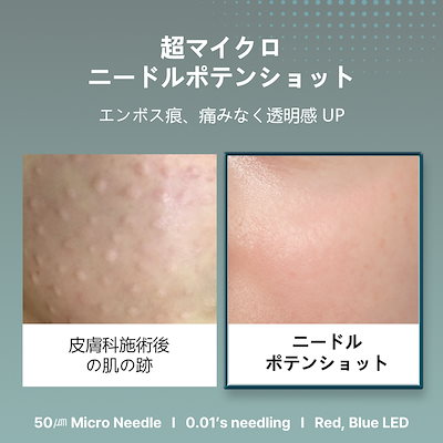 Qoo10] HONBODY 【公式】 ニードルポテンショット 美顔器