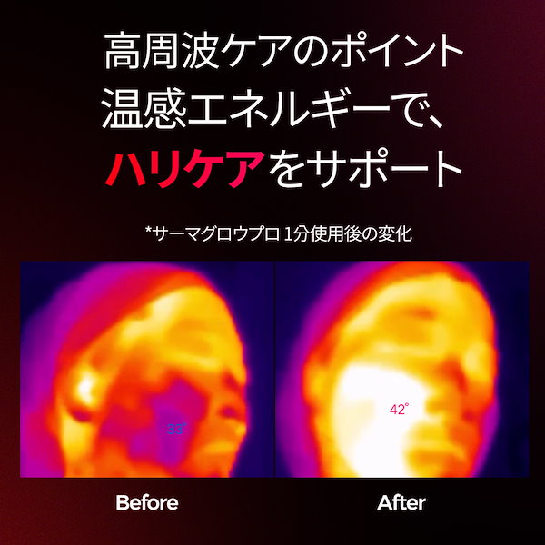 Qoo10] Benove [スパ級ハリケア] ビノーブTherma