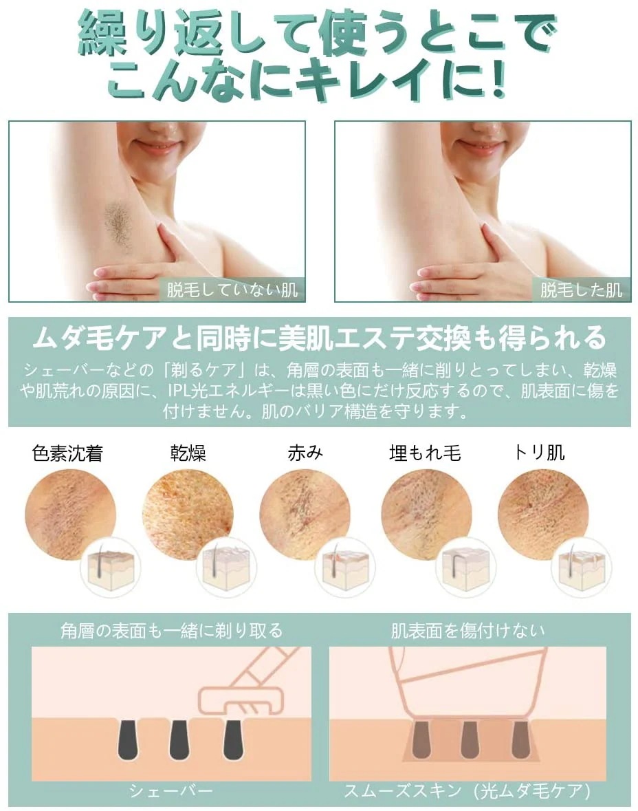 脱毛器 IPL光脱毛器 99万回照射 VI 全身脱毛 家庭用 ８週間脱毛済み 5段階調節 お肌に優