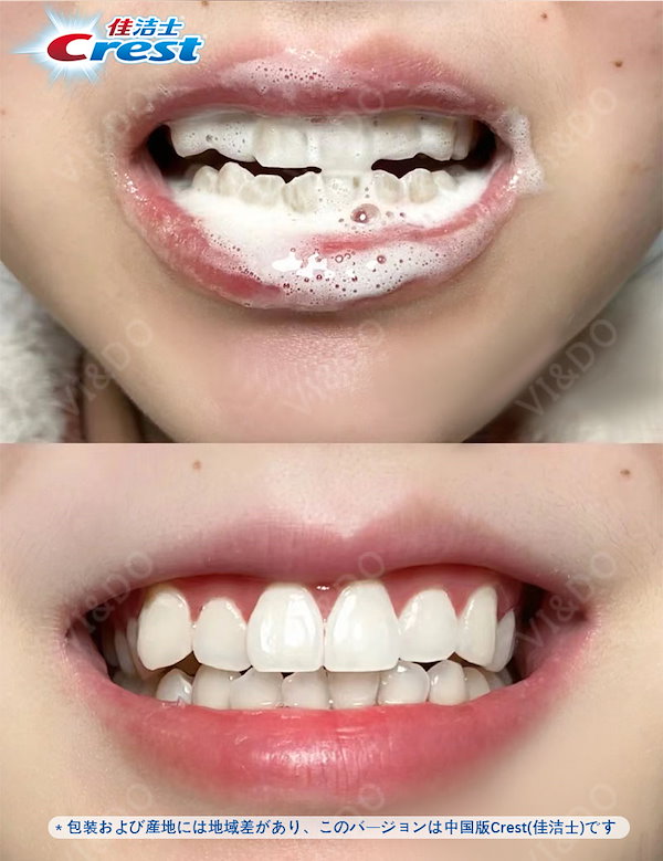 歯みがき粉 薬用知覚過敏ケア歯みがき粉 | 無印良品