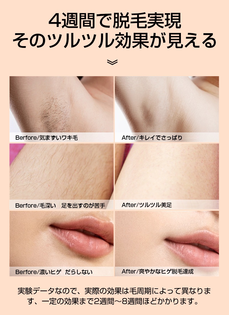 脱毛器 IPL光脱毛器 冷感 99万回フラッシュ 家庭用 光エステ 男女兼用 美肌機能 冷却クーリング 全身ムダ毛処理