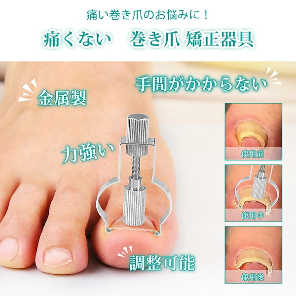 Qoo10] 巻き爪 矯正 器具 自宅で矯正 【最新改