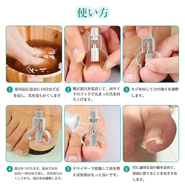 Qoo10] 巻き爪 矯正 器具 自宅で矯正 【最新改
