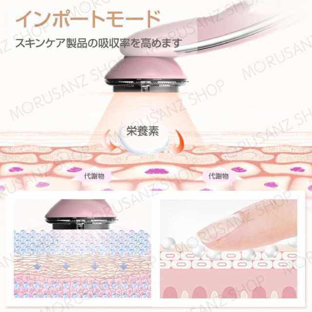 超音波美顔器 EMS RF美顔器 RF 振動 LED エステ 光エステ ニキビ フェイスケア 毛穴 USB充電 説明書付き 振動マッサージ器 電子美容器 超音波美顔器 EMS RF美顔器 RF 振動 LED エステ 光エステ ニキビ フェイスケア 毛穴 USB充電 説明書付き 振動マッサージ器 電子美容器