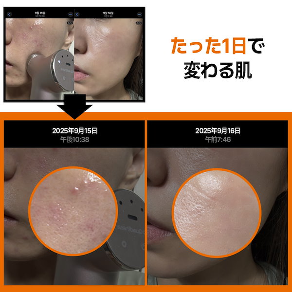 Qoo10] Quadthera 【T1お家でクリニック級ケア】TITAN