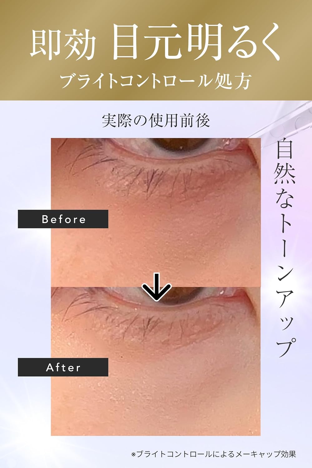 ルジョー ニードルセラムブライト 9g lujo 針美容液 目の下 クマ 目のクマ取りクリーム 美容クリーム 目元