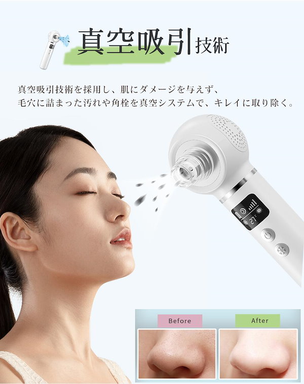 Qoo10] peipai 温冷毛穴吸引器 美顔器 6種類の吸引ノズ