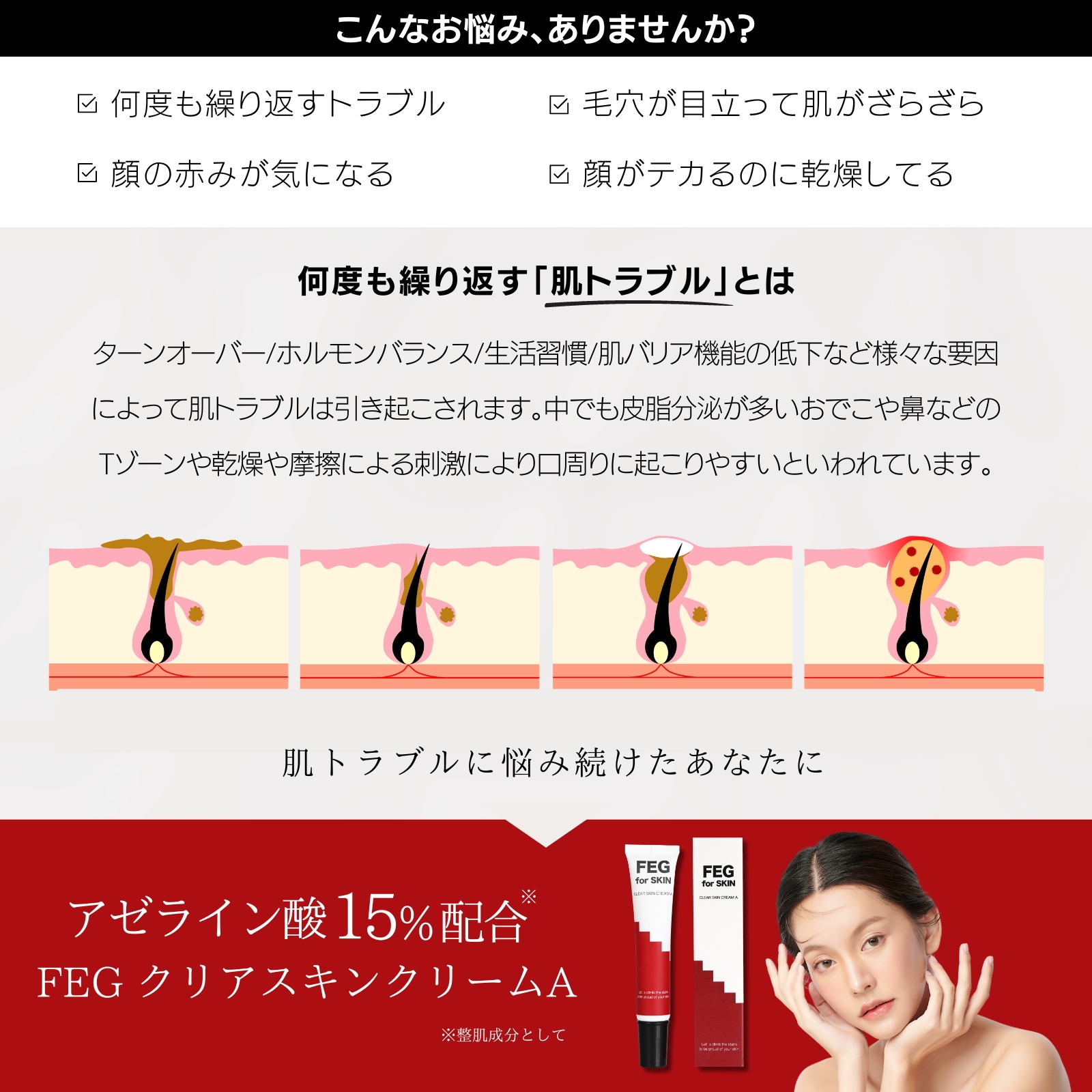 Qoo10] FEG 【本日限定特価】［FEG公式］アゼライン