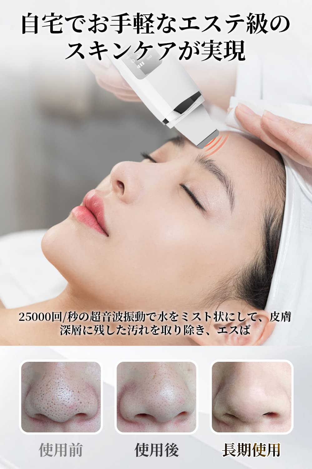 Spre kayou ウォーターピーリング 美顔器 ems 超音波ピーリングイオン導出 イオン導入 E M S 1台4役 イオン美顔器 防水 汚れ除去 超音波振動 USB充電式 持ち運びやすい 誕生日 mdprevattcaulkingandwaterproofing.com