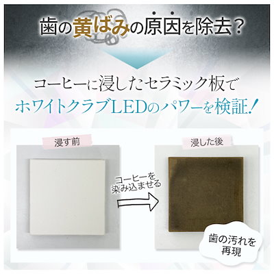 セルフホワイトニングキットまとめ売り 楽天市場】ホワイトニングキットの通販